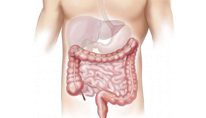 Literature review reveals global rise in gastrointestinal cancers, with colorectal cancer leading the trend